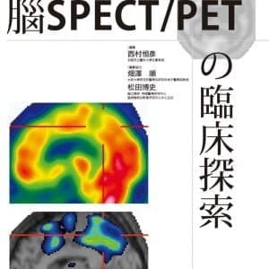 腦SPECT/PETの臨床探索(第3版)